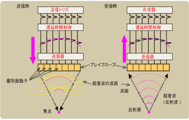 超音波検査機器