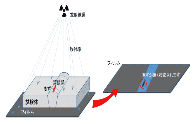 放射線検査とは？